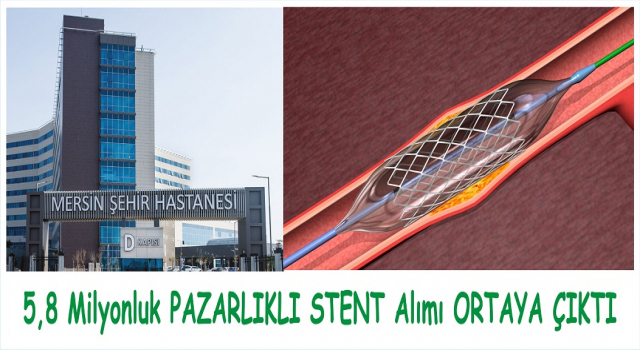 ŞEHİR HASTANESİNDE 5,8 MİLYONLUK PAZARLIKLI STENT ALIMI ORTAYA ÇIKTI