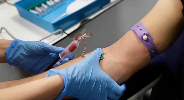 Avrupa’da büyüyen ‘sessiz kriz’: Teşhis edilmemiş HIV