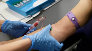 Avrupa’da büyüyen ‘sessiz kriz’: Teşhis edilmemiş HIV